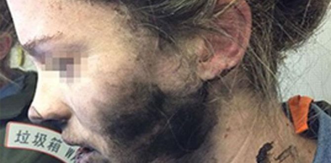 Headphone explosion 670x330 - Woman Suffers Burns as Headphones Catch Fire During Flight to Australia